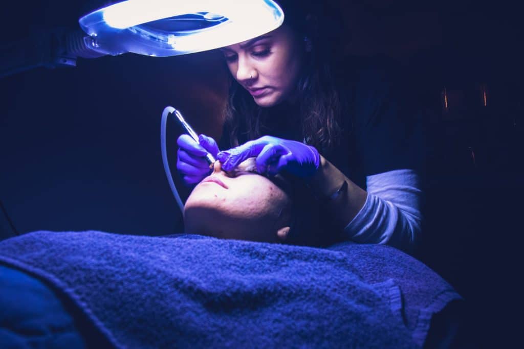 microdermabrasion treatment