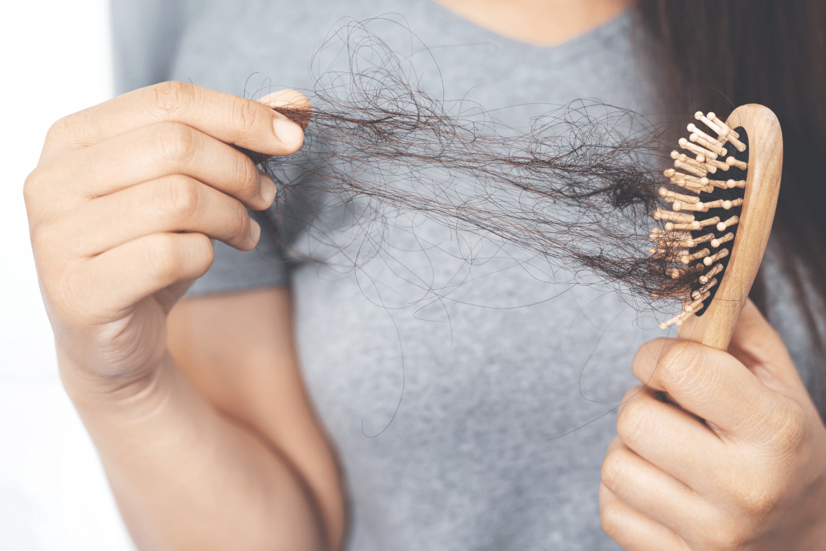 hair loss alopecia