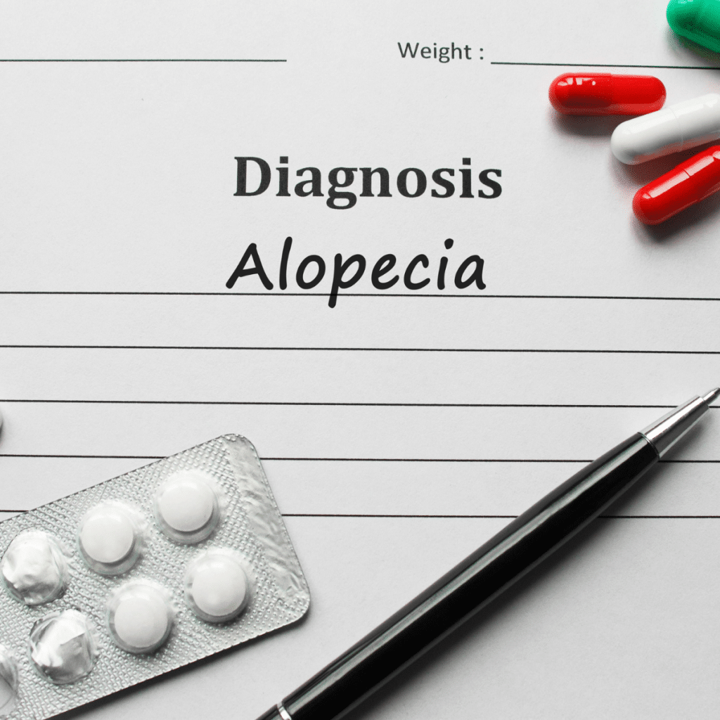 diagnosis alopecia