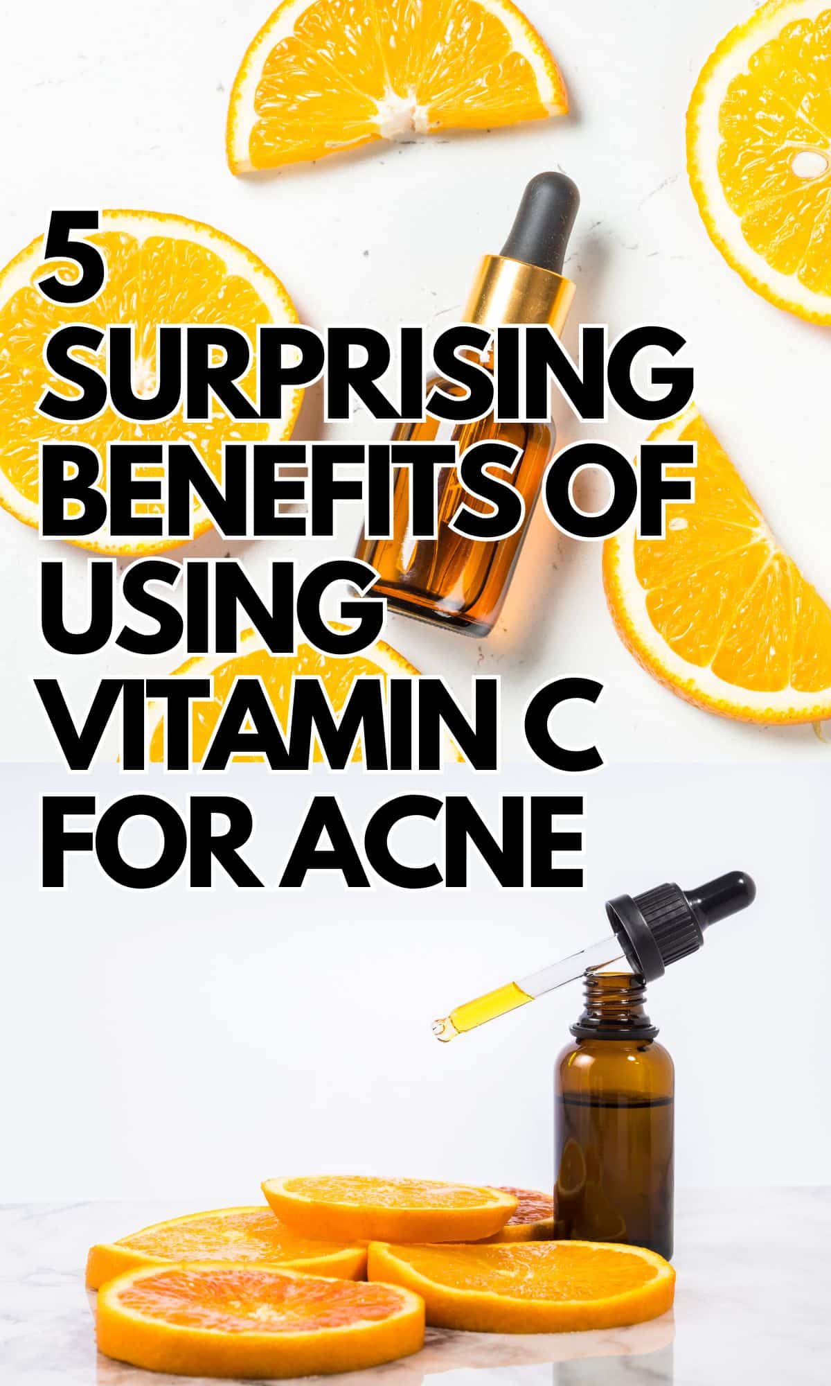 5 surprising benefits of using vitamin c for acne