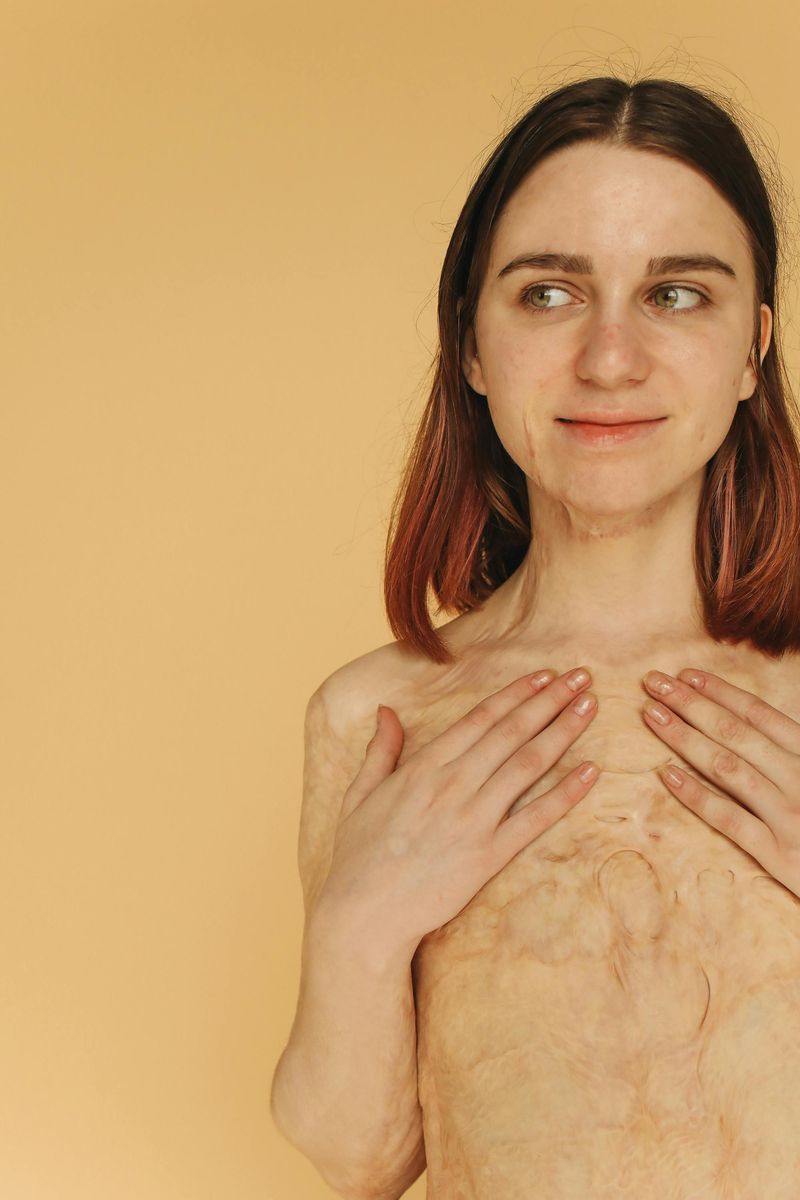 The Need to Be Accepted as You Are