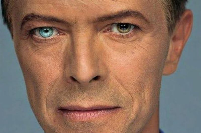 David Bowie's Permanently Dilated Pupil