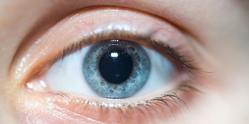 Dilated Pupils