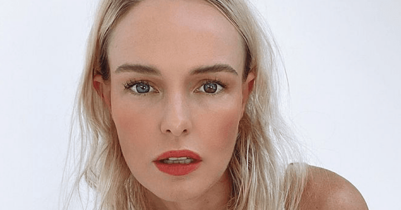Kate Bosworth's Two Different Eye Colors