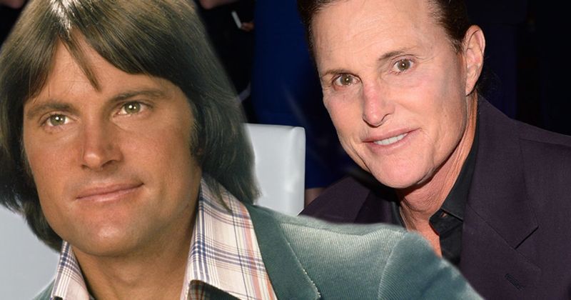 Bruce Jenner: Cosmetic Work During His Years in the Public Eye