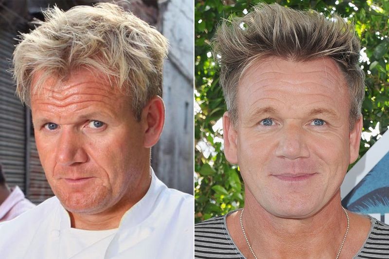 Gordon Ramsay: The Chef Who Seasoned His Look With Fillers
