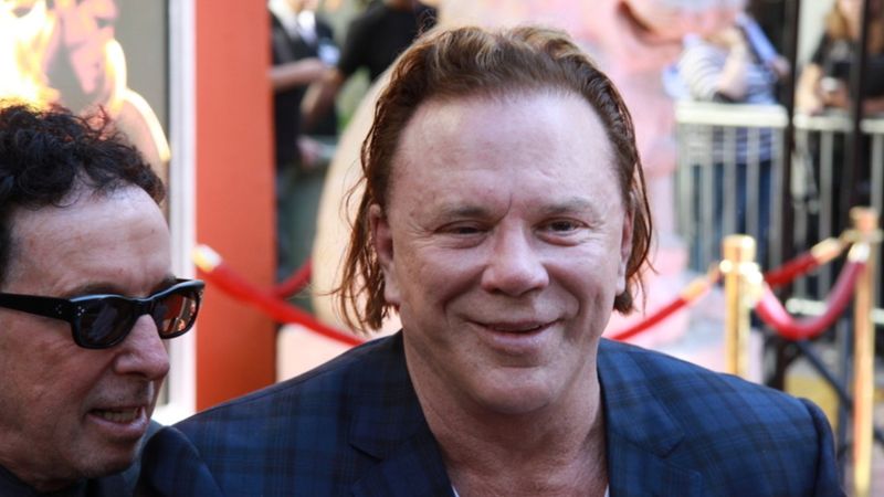 Mickey Rourke: Reconstructive Surgery After a Brutal Boxing Career