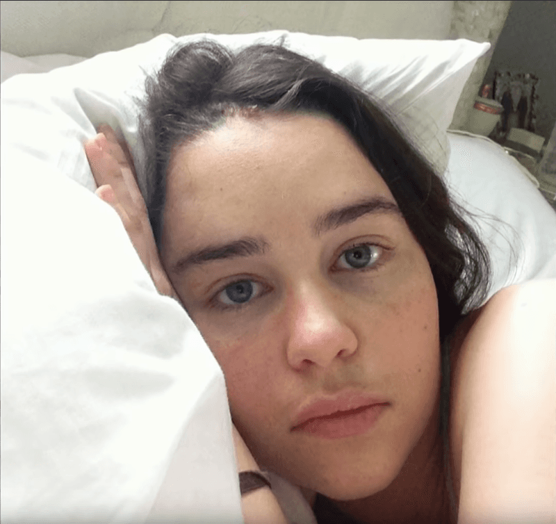 Emilia Clarke – Brain Aneurysms