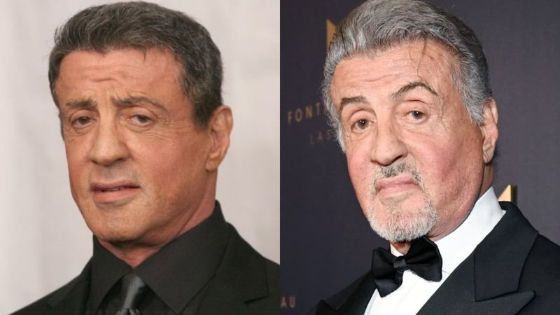 Sylvester Stallone: Action Hero, Cosmetic Procedure Veteran