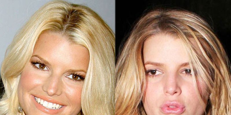 Jessica Simpson