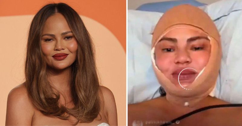 Chrissy Teigen