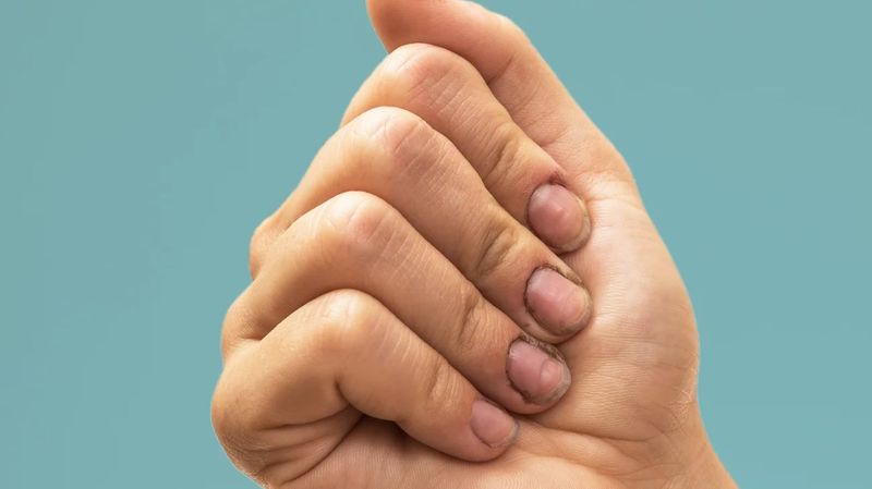 Letting Personal Hygiene Slide