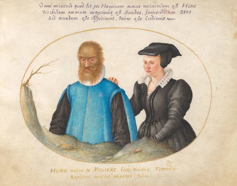 Petrus Gonsalvus - The Beast Behind the Tale