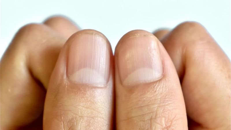 The Condition of Your Nails