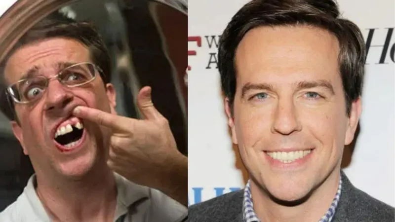 Ed Helms' Real Missing Tooth